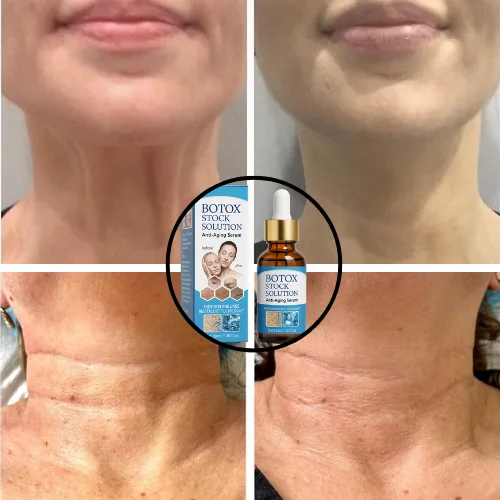 LINEAS FINAS DE EXPPRESION